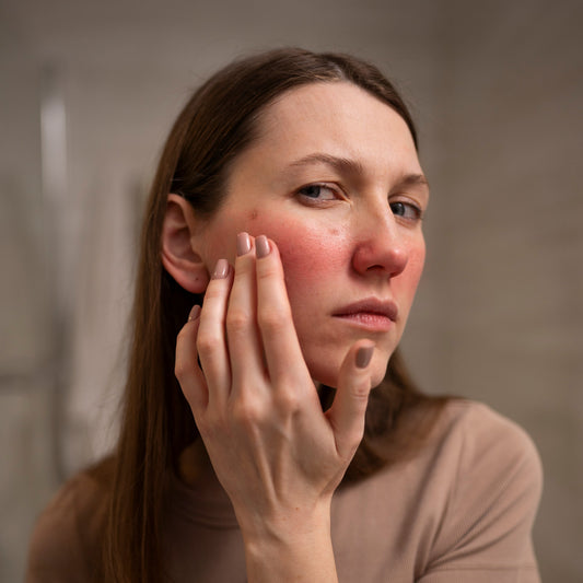 The Connection Between Stress and Skin